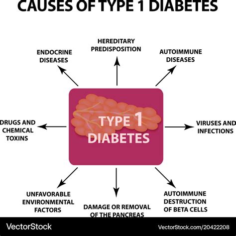 Causes diabetes type 1 infographics Royalty Free Vector