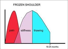 Frozen Shoulder Sydney | Adhesive Capsulitis Randwick | Australia