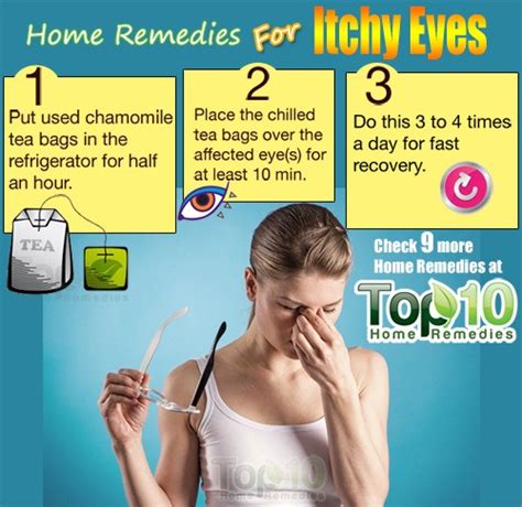 Home Remedies for Itchy Eyes | Top 10 Home Remedies