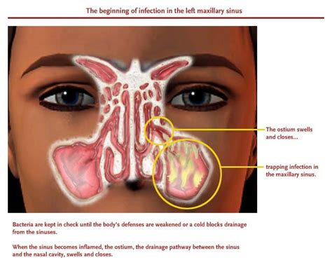 Nose Sinus | All Yours