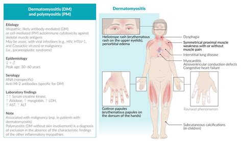 Keith Siau on Twitter: "These are Gottron’s papules in keeping with dermatomyositis, an ...