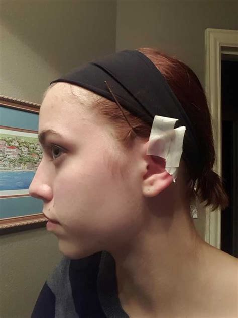 DIY Tape Elf Ears - Imgur | Elf ears, Diy elf costume, Elf cosplay