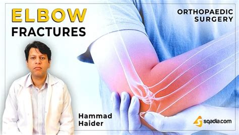 Elbow Fractures - Introduction