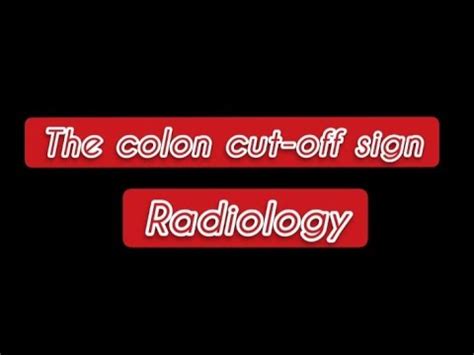 Colon cut off sign - Abdominal XRay findings - Basic Radiology - YouTube