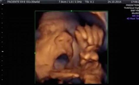 The Good News Today – Video Shows Unborn Baby at 18 Weeks ‘Singing’ to ...