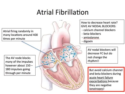 EKG – 2 – Atrial Fibrillation with Rapid Ventricular Response – EMHUM