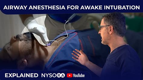 Airway Anesthesia for Awake Intubation - Crash course with Dr. Hadzic - YouTube