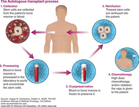 Autologous Hematopoietic Progenitor Cell Transplantation | Oncohema Key