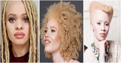 9 hairstyles ideas for albino women – Afroculture.net