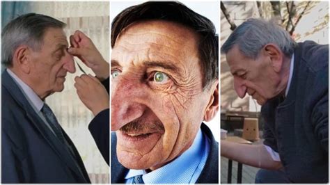 My Friends Used to Laugh at Me: Man With World’s Longest Nose Speaks in Viral Video, Stirs ...