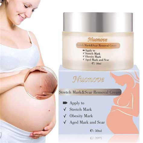 Stretch Mark Cream for Pregnancy, Stretch Mark Scar Cream, Postpartum ...