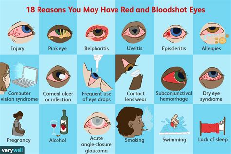 Bloodshot Eyes: 20 Reasons Why Eyes Are Red