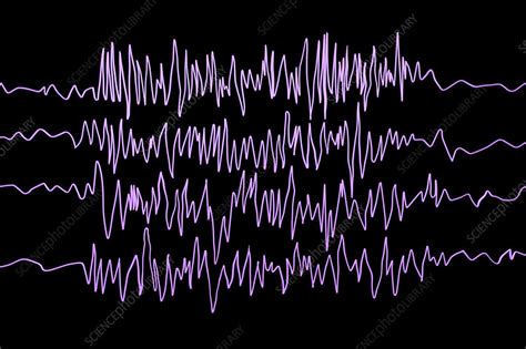 Brain waves in epilepsy, illustration - Stock Image - F021/3563 - Science Photo Library