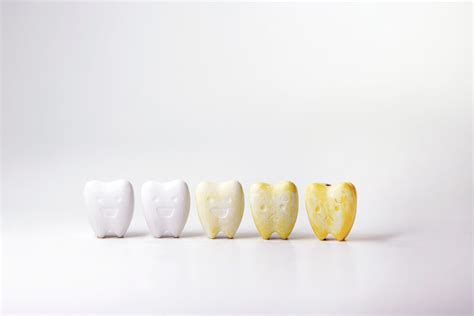 Understanding Tooth Discoloration: Causes and Treatment Options | Triangle Dentistry