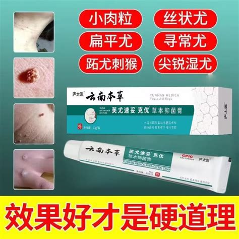 Flat Warts Removal Wart wart Removal wart wart removal wart wart ...