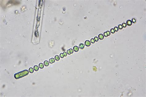 Anabaena circinalis | The Microscopic Life of Shetland Lochs