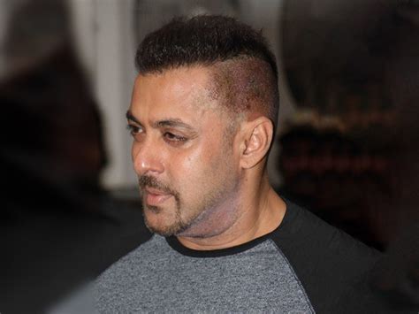 Why did Salman Khan have 3 Hair Transplants