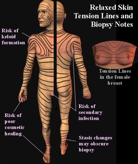 Relaxed Skin Tension Lines