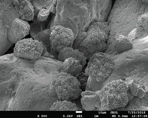 SEM of calcium carbonate crystals induced by screened pure culture with... | Download Scientific ...