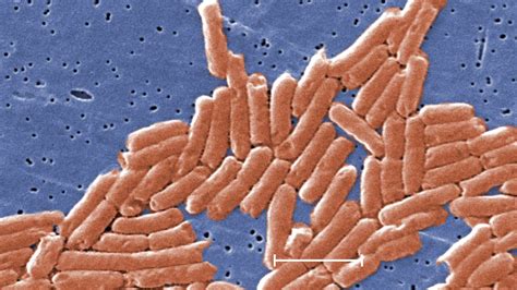 Nationwide Salmonella outbreak kills one and sickens nearly 1,000 people in the U.S. - Strange ...