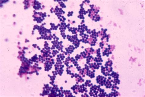 Pin on Staph Aureus Gram stain