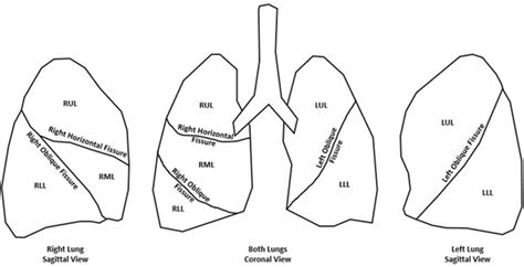 Fissures of the lungs. The right horizontal fissure separates the right ...