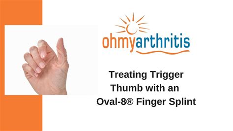 How to Treat Trigger Thumb with an Oval-8 Finger Splint - Oh My Arthritis - YouTube
