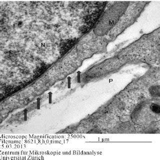 Pseudopod-like structures (P), Arrows: Vacuoles, N: nucleus, M:... | Download Scientific Diagram