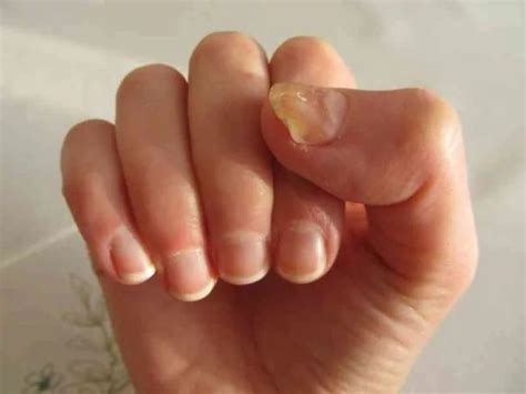 How Your Nails Warn You About Serious Health Conditions - The Health ...