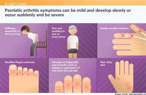 Psoriatic Arthritis - Symptoms, Causes, Treatment & More