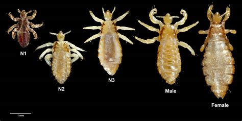 Body Lice - What Does Body Lice Look Like? - Symptoms & Treatment