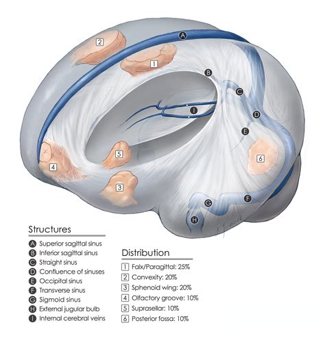 Olfactory Groove Meningioma | The Neurosurgical Atlas