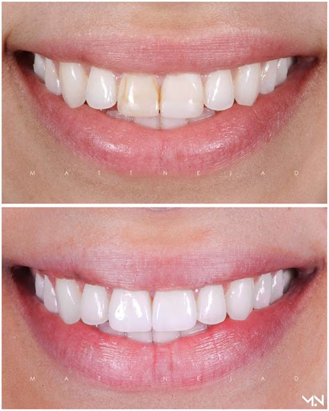 Cosmetic Dentistry Before and After Photos | Helm Nejad Stanley