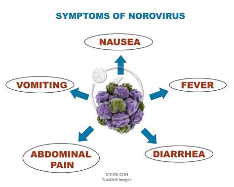 Medical diagram showing symptoms of the norovirus. | Stocktrek Images