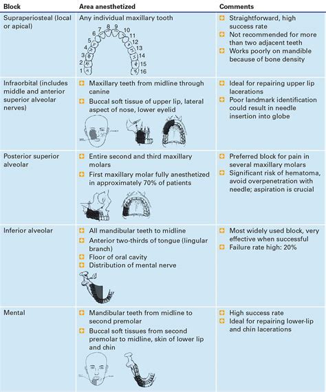 Dental Nerve Blocks | Anesthesia Key