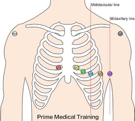 The Ultimate 12-Lead ECG Placement Guide (With Illustrations)