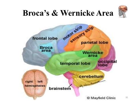 Pin by Vanessa Harkness on CNRN | Wernicke's area, Occipital lobe ...