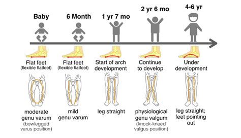 Children’s Foot Development – Footarch Pro