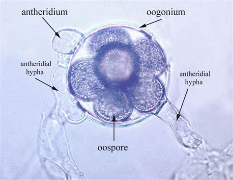 Plant pathology, Microbiology, Fungi