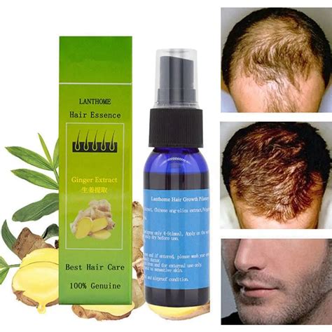 Aliexpress.com : Buy Professional Anti Hair Loss Hair Growth Liquid ...