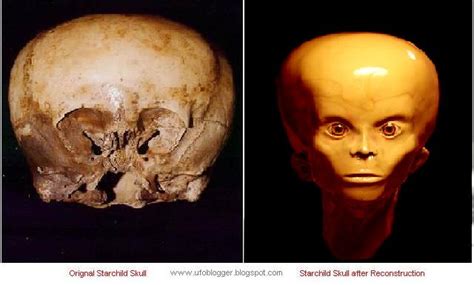 THE STARCHILD SKULL – Mohammed Abbasi