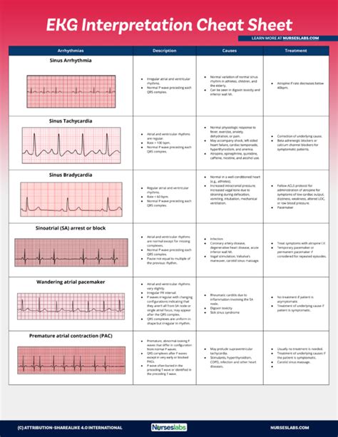 EKG Interpretation Cheat Sheet (Free Download) | Ekg interpretation cheat sheets, Ekg ...