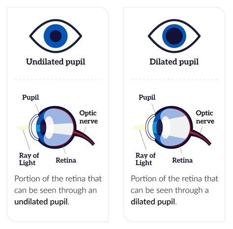 Get a Dilated Eye Exam | National Eye Institute | Eye exam, Eye exercises, Exam