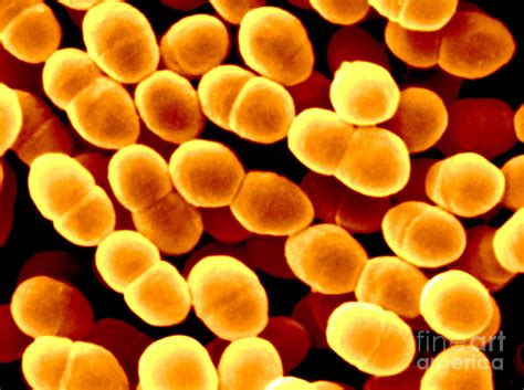 Lactococcus Lactis Photograph by Scimat - Fine Art America