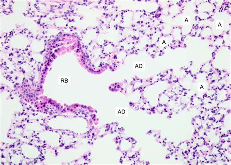 Conducting Bronchioles Histology