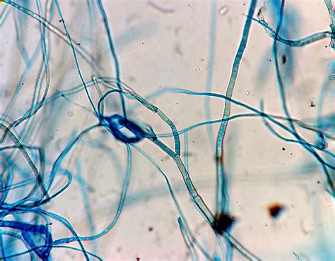 Hyphae Of Fungi Microscope