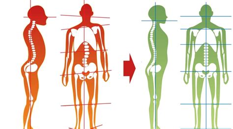 Cure for Dystonia | My story on overcoming Dystonia