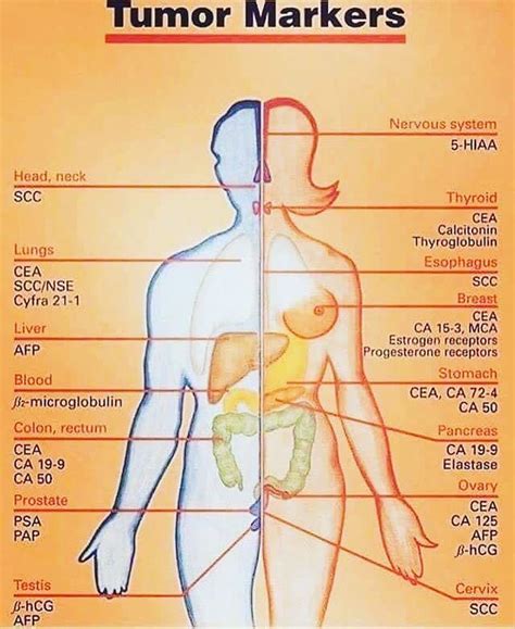 Tumour markers | Oncology nursing, Medical knowledge, Medical laboratory science