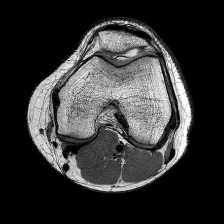 Knee Muscle Anatomy Mri / MRI knee - Google Search | Mri, Mri school ...