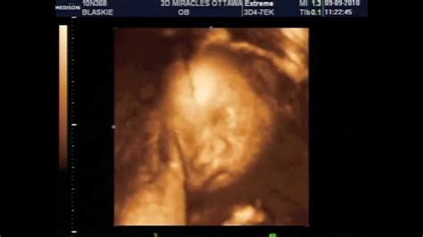 30 weeks pregnant 3d ultrasound - sayguy